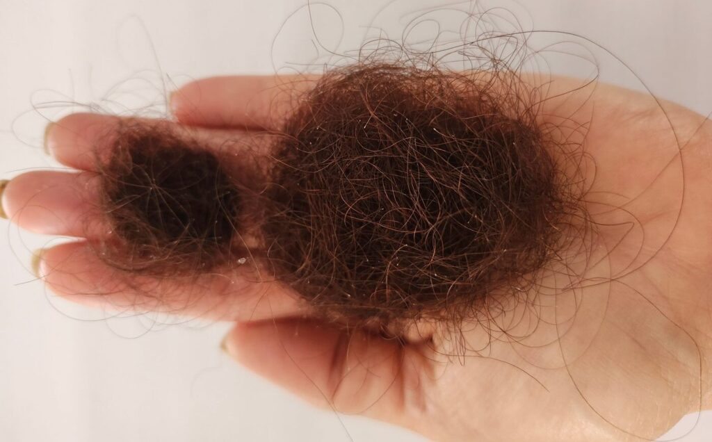Mechón de cabello caído recogido en la palma de la mano
